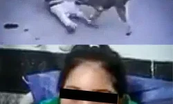 حمله سگ به دختر 8 ساله حمله سگ به دختر 8 ساله